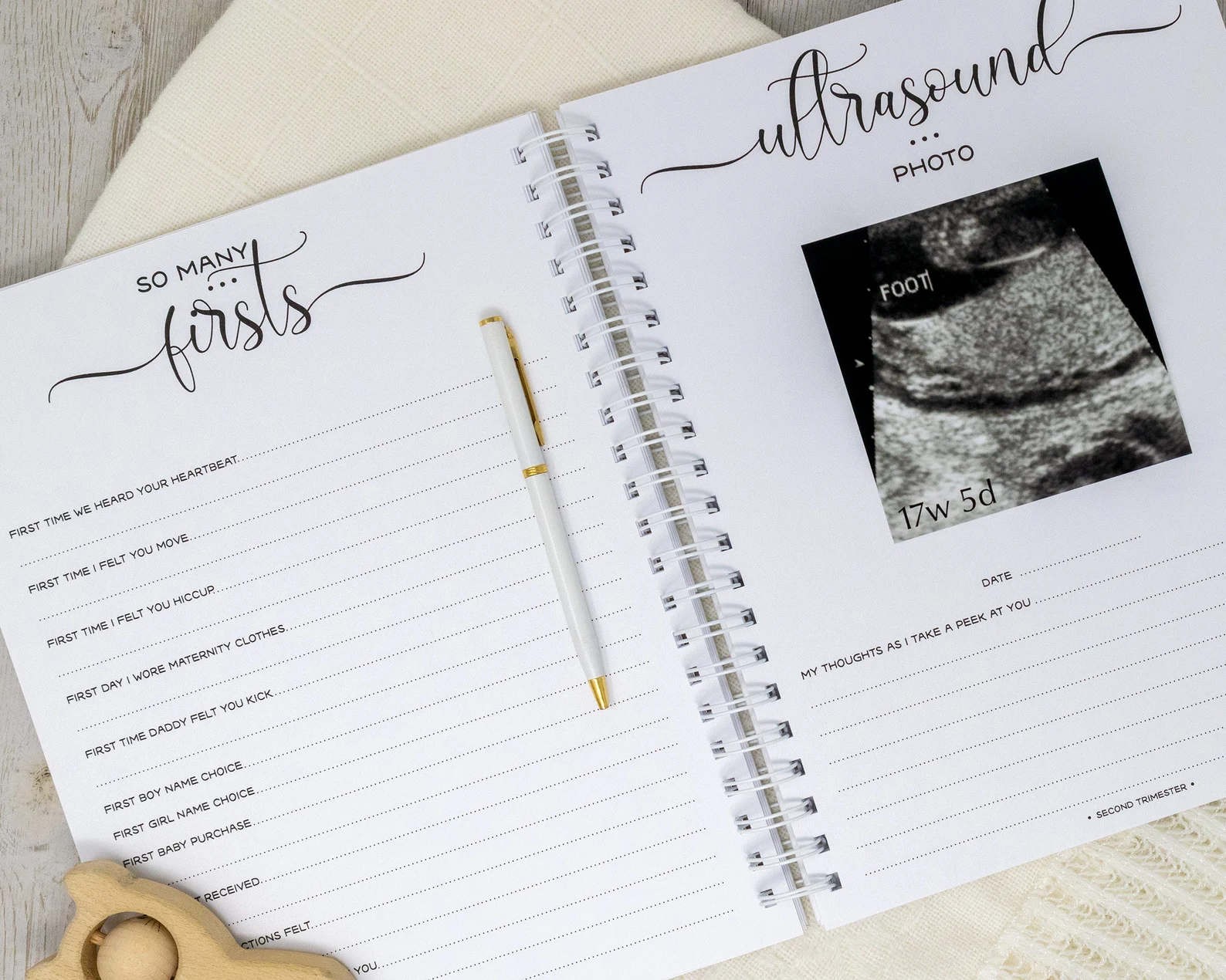 Hard Cover Pregnancy Journal & Memory Book for Expectant Moms - Personalized Keepsake Pregnancy Album - New Mother Gift - Woodsy Friends